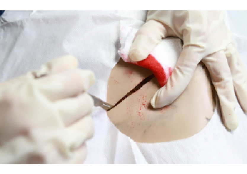 穿戴式腹股沟手术训练套装