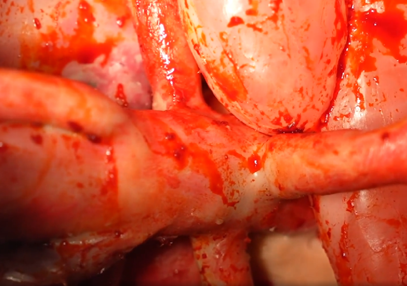 胸腹部损伤控制手术模拟人系统3.0